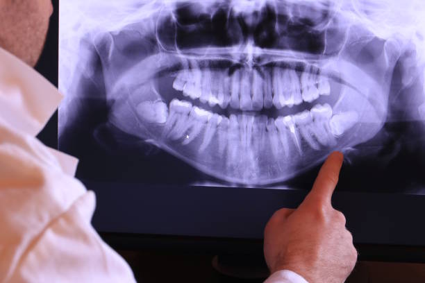 Best Weekend Emergency Dentist in South Pottstown, PA