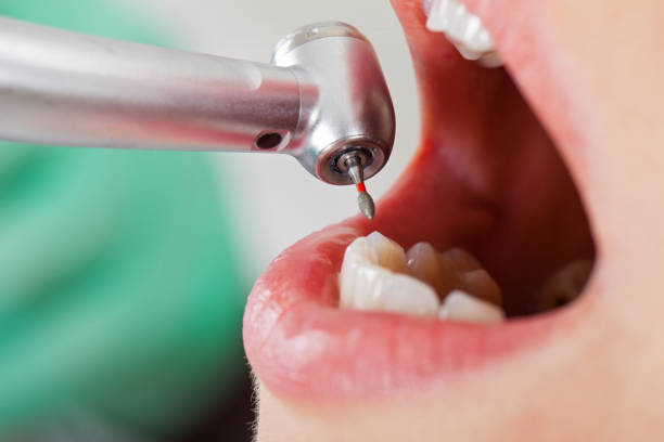 Best Emergency Denture Repair in South Pottstown, PA